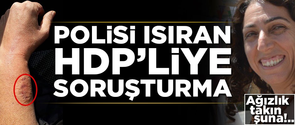 Polisi ısıran HDP'li hakkında soruşturma