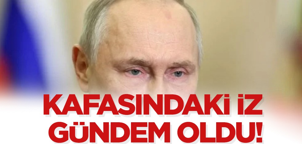 Putin'in kafasında olan o iz gündemde, olay oldu: Rusya’da Kanser iddiası şoku! Yok ya dedirtti!