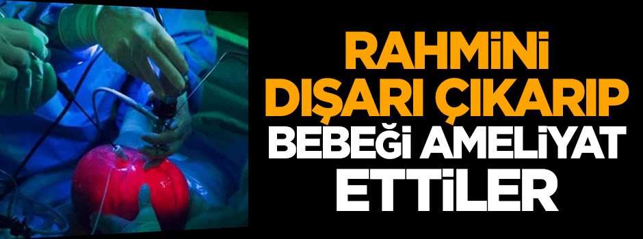 Rahmini dışarı çıkarıp bebeği ameliyat ettiler