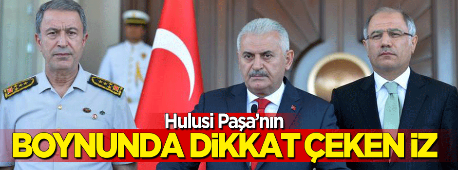 Rehin alınan Akar'ın boynunda dikkat çeken iz!