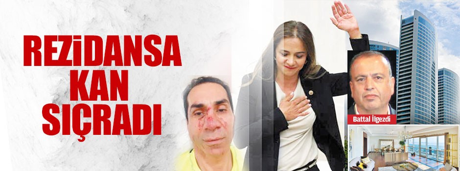 Rezidansa kan sıçradı