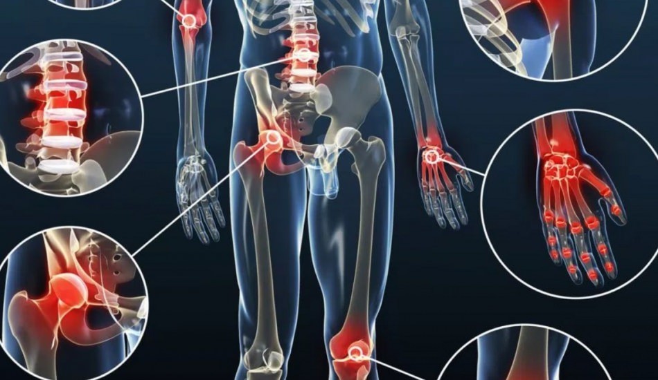Romatizmal hastalıklar neler?