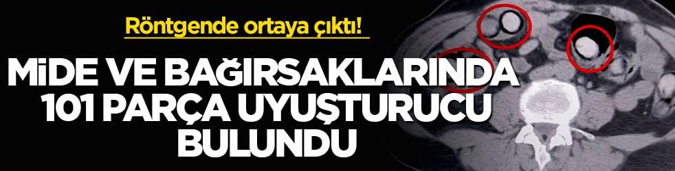 Röntgende ortaya çıktı! Mide ve bağırsaklarında 101 parça uyuşturucu bulundu