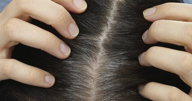 Saç dipleri neden ağrır ve nasıl geçer?