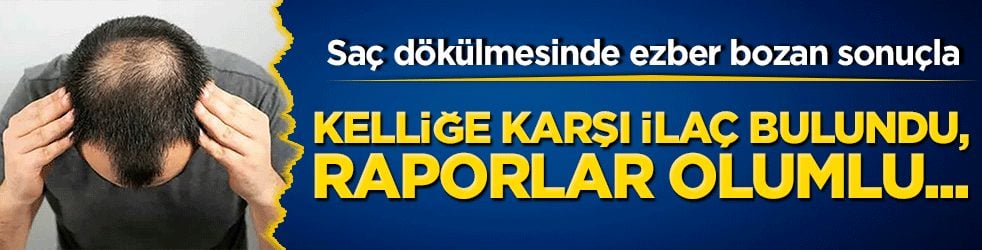 Saç dökülmesinde ezber bozan sonuçlar: Kelliğe karşı ilaç bulundu, raporlar olumlu...