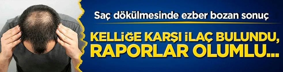 Saç dökülmesinde ezber bozan sonuçlar: Kelliğe karşı ilaç bulundu, raporlar olumlu...