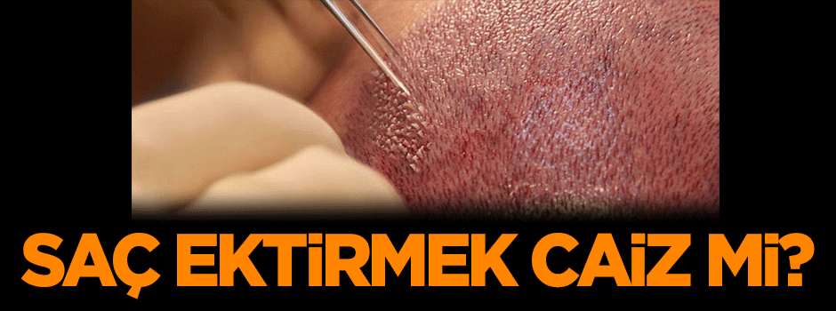 Saç ektirmek caiz midir? Abdest ve gusle engel olur mu?
