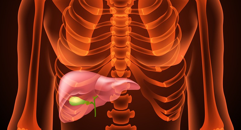 Safra kesesi olmayanlar hangi besinleri sindiremez?
