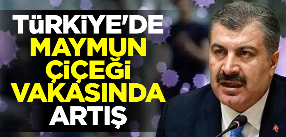  Sağlık Bakanı Fahrettin Koca: Türkiye'de 5 maymun çiçeği vakası tespit edildi