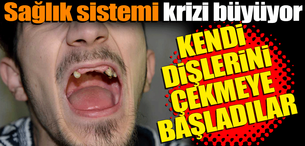Sağlık sistemi krizi büyüyor: Bu kez de kendi dişlerini çekmeye başladılar