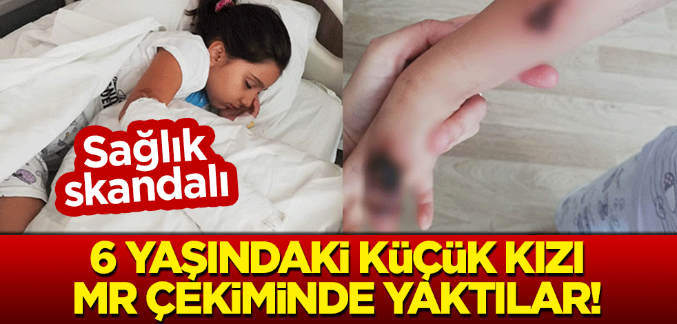 Sağlık skandalı: 6 yaşındaki küçük kızı MR çekiminde yaktılar!