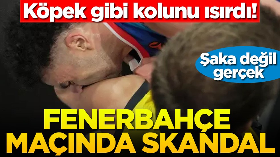 Şaka değil gerçek: Köpek gibi kolunu ısırdı! Fenerbahçe maçında skandal