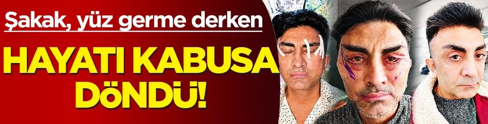Şakak, boyun, yüz germe derken: Gençleşmek isterken hayatı kabusa döndü! Gözlerini kapatamıyor