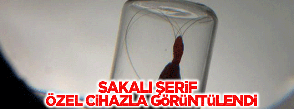 Sakal-ı Şerif özel cihazla görüntülendi