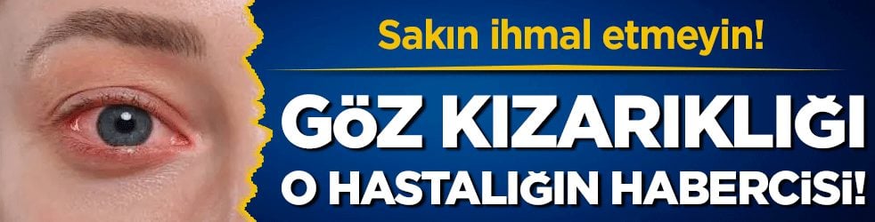 Sakın ihmal etmeyin: Göz kızarıklığı o hastalığın habercisi!