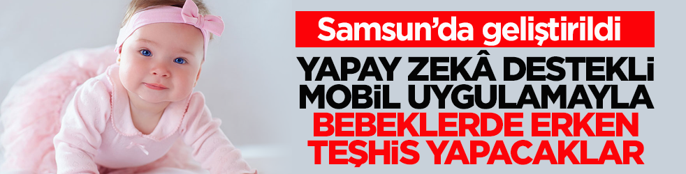 Samsun’da geliştirildi! Yapay zekâ destekli mobil uygulamayla bebeklerde erken teşhis yapacaklar
