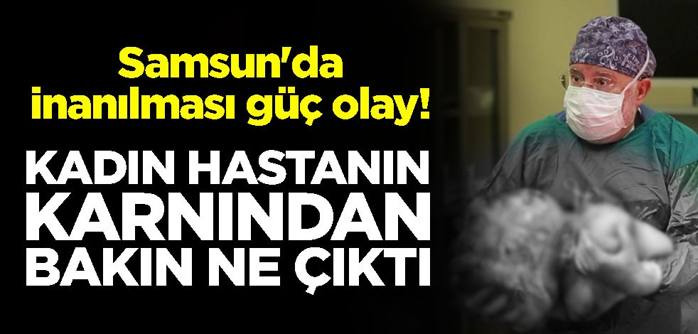 Samsun'da inanılması güç olay! Kadın hastanın karnından dev kitle çıktı