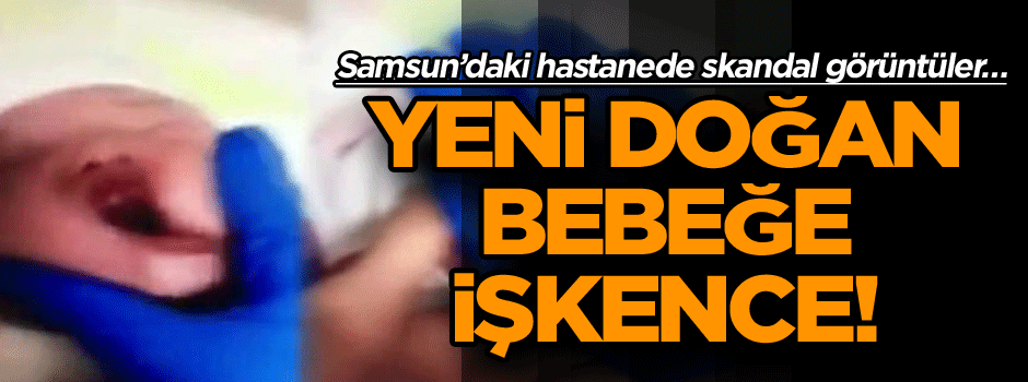 Samsun’daki hastanede skandal görüntüler… Yeni doğan bebeğe işkence!