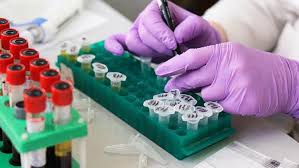 Sars virüsü nedir?