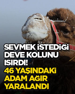 Sevmek istediği deve kolunu ısırdı! 46 yaşındaki adam ağır yaralandı