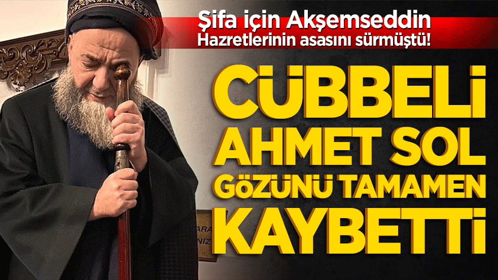 Şifa için Akşemseddin Hazretlerinin asasını sürmüştü! Cübbeli Ahmet sol gözünü tamamen kaybetti
