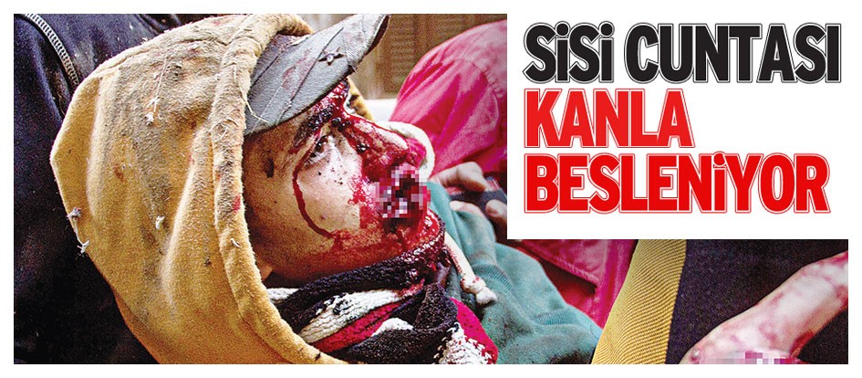 Sisi cuntası kanla besleniyor