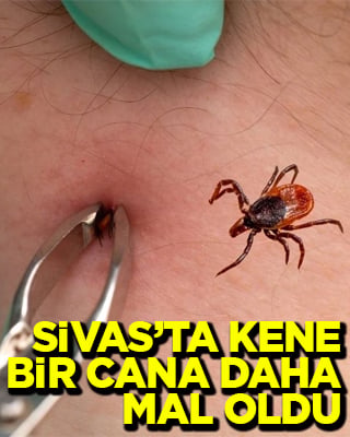 Sivas’ta kenenin ısırdığı 60 yaşındaki vatandaş kurtarılamadı
