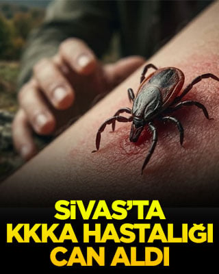 Sivas’ta KKKA hastalığı can aldı