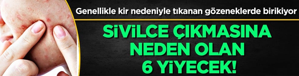 Sivilce çıkmasına neden olan 6 yiyecek: Şaşırtan liste... Eğer bu yiyecekler varsa terk edin