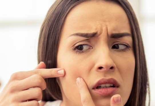 Sivilcelerin kızarıklığı nasıl giderilir?