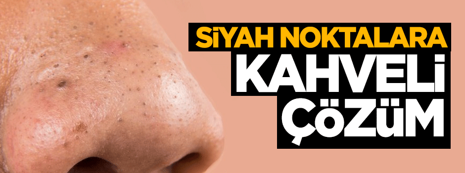 Siyah noktalara Türk kahvesiyle son verin