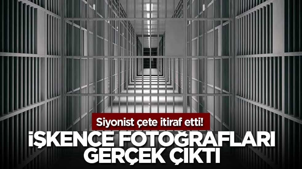 Siyonist sürüsü itiraf etti! İşkence fotoğrafları gerçek çıktı