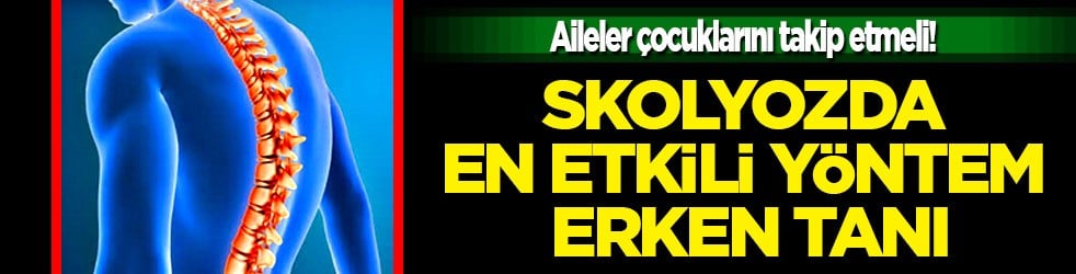 Skolyozun tedavisi erken tanıyla kontrol altına alınabilir: Omurga eğriliğinin derecesi b&uuml;y&uuml;k &ouml;nem taşır 