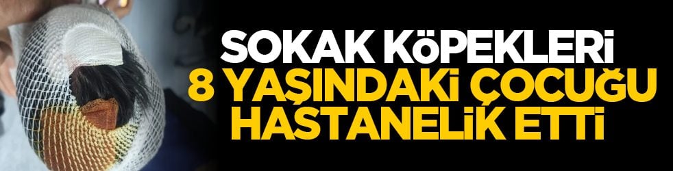Sokak köpekleri 8 yaşındaki çocuğu hastanelik etti