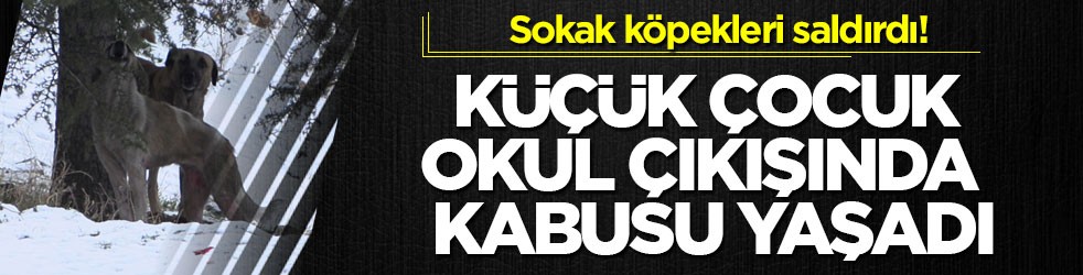 Sokak köpekleri saldırdı! Küçük çocuk okul çıkışında kabusu yaşadı