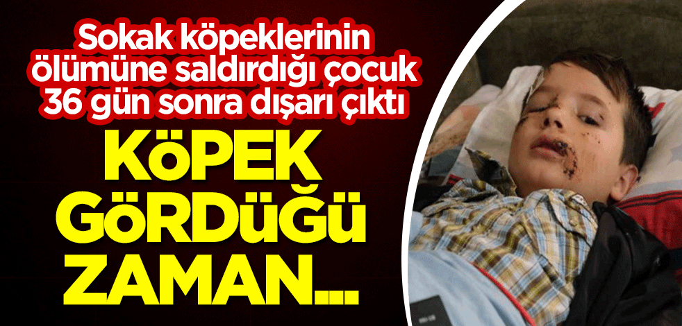 Sokak köpeklerinin ölümüne saldırdığı çocuk 36 gün sonra dışarı çıktı: Köpek gördüğü zaman...