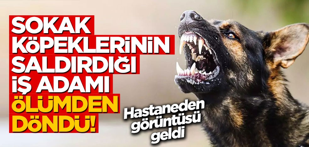 Sokak köpeklerinin saldırdığı iş adamı ölümden döndü! "Ben orada ölebilirdim"