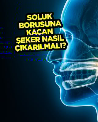 Soluk borusuna kaçan şeker nasıl çıkarılmalı? Böyle yapılıyor diyerek açıklandı