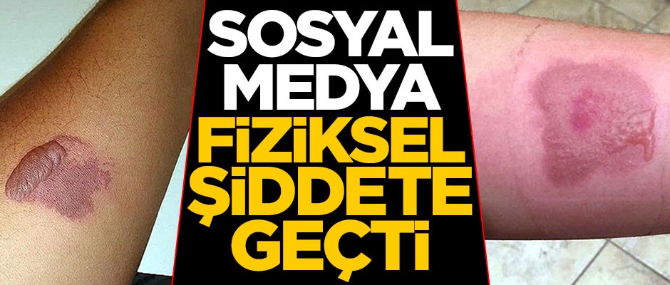 Sosyal medya fiziksel şiddete geçti