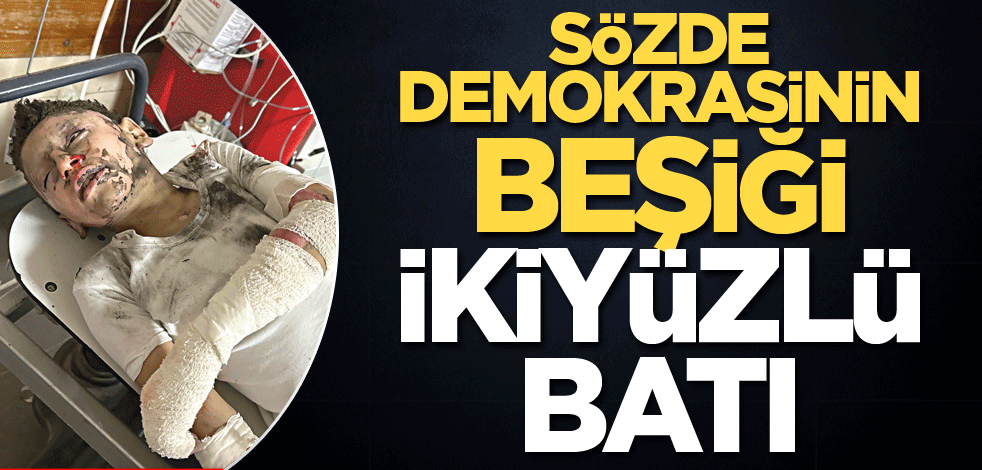Sözde demokrasinin beşiği İkiyüzlü Batı