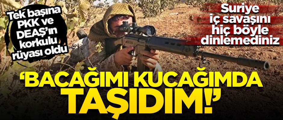 Suriye iç savaşını hiç böyle dinlemediniz! "Bacağımı kucağımda taşıdım"