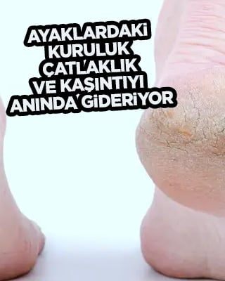 Suya bir kaşık atmanız yeterli! Ayaklardaki kuruluk çatlaklık ve kaşıntıyı anında gideriyor
