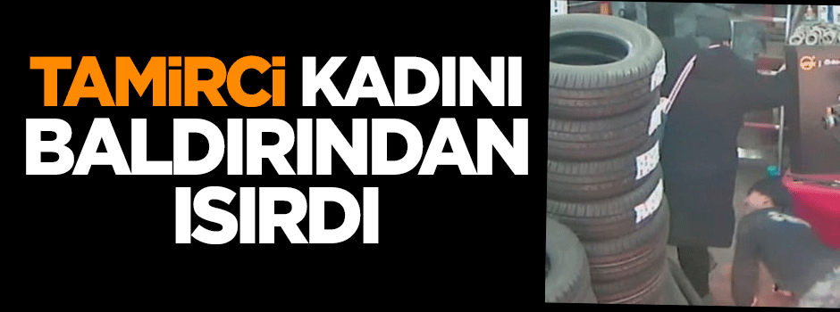 Tamirci, kadını baldırından ısırdı