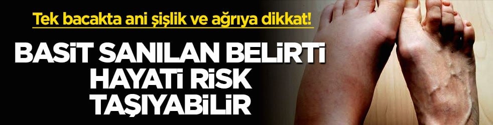 Tek bacakta ani şişlik ve ağrıya dikkat! Basit sanılan belirti hayati risk taşıyabilir