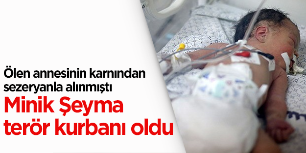 Terör kurbanı Gazzeli minik Şeyma hayata tutunamadı