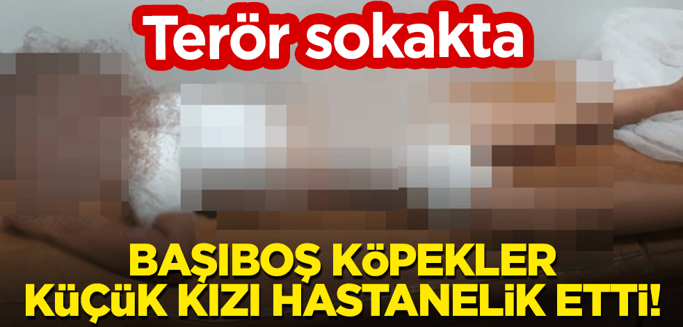 Terör sokakta: Başıboş köpekler, küçük kızı hastanelik etti!