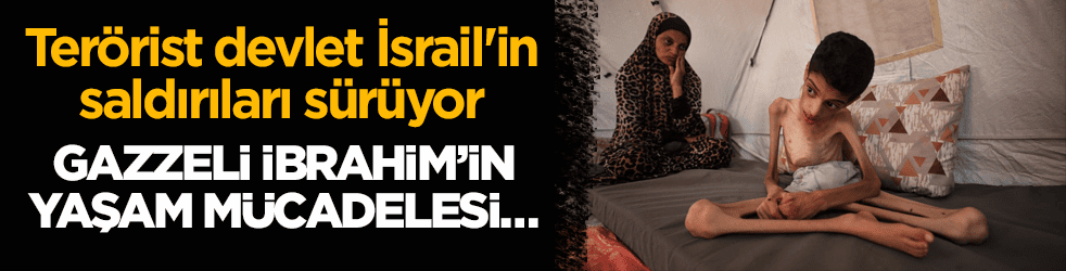 Terörist devlet İsrail'in saldırıları sürüyor! Gazzeli İbrahim’in yaşam mücadelesi…