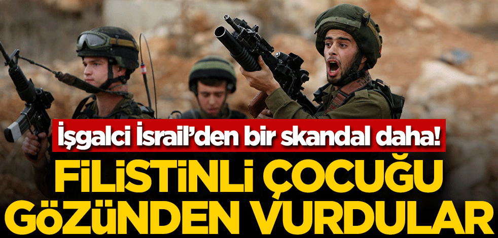 Terörist İsrail güçleri, Filistinli çocuğu gözünden vurdu