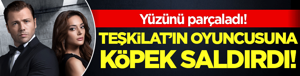 Teşklat'ın oyuncusuna köpek saldırdı! Yüzünü parçaladı!