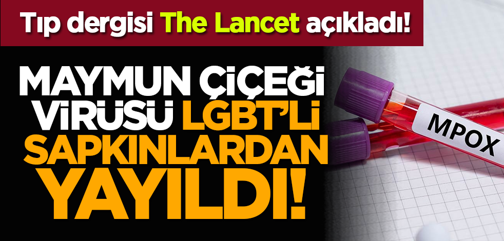 Tıp dergisi The Lancet açıkladı: Maymun çiçeği virüsü LGBT sapkınlarından yayıldı!
